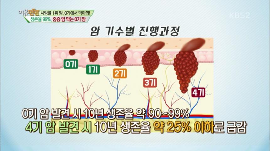 KBS2 ‘여유만만’ 방송 캡처