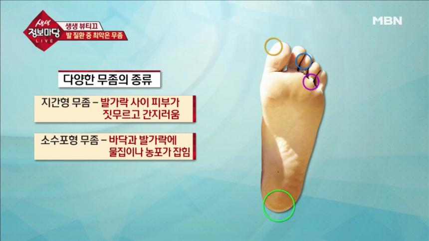 MBN ‘생생 정보마당’ 방송 캡처