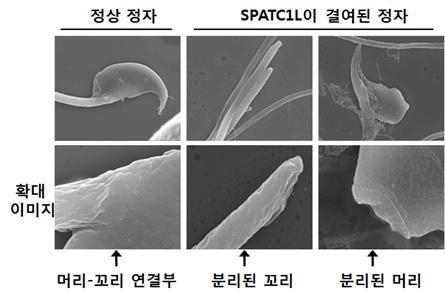 정상 정자와 SPATC1L이 결여된 비정상 정자를 비교한 모습. 주사전자현미경(scanning electron microscopy)으로 관찰했다. [한국연구재단 제공=연합뉴스]
