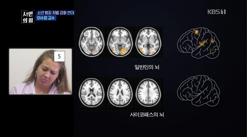 KBS1 ‘토론쇼 시민의회’ 방송 캡처