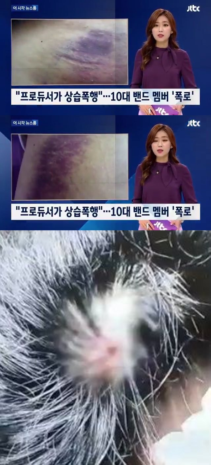 더 이스트라이트 상처 / JTBC 방송 캡처, 온라인 커뮤니티