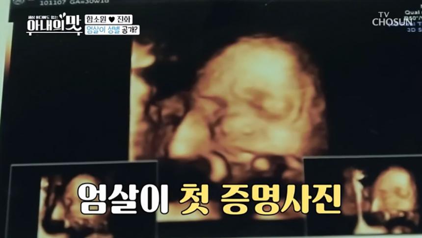 함소원 임신 엄살이 사진