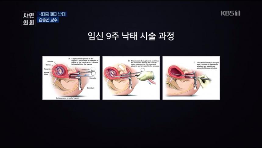 KBS1 ‘시민의회’ 방송 캡처