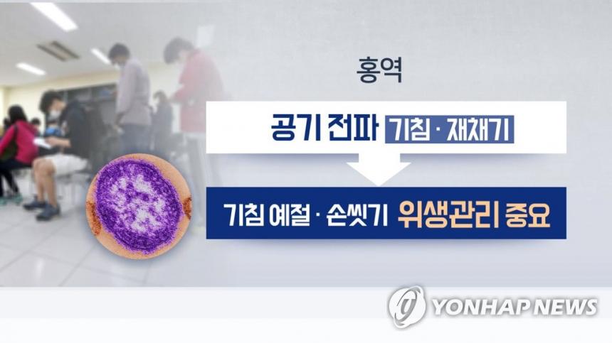 홍역 예방 방법 / 연합뉴스