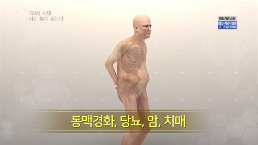 KBS1 ‘시사기획 창’ 방송 캡처