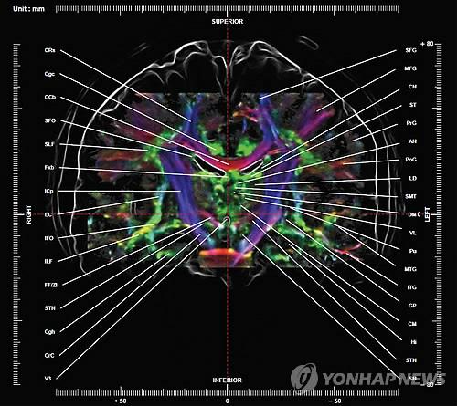 세계 최초로 제작된 '뇌 신경 지도' / [가천대 뇌과학연구소 제공]