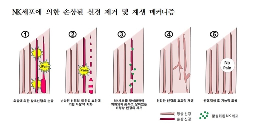 자연살해세포에 의한 손상 신경 제거 및 재생 과정 / [서울대 제공]