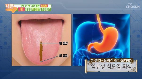 혀 / TV조선 ‘내 몸 사용 설명서’ 방송캡처