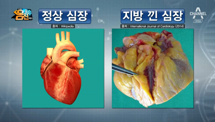 채널A ‘나는 몸신이다’ 방송 캡처