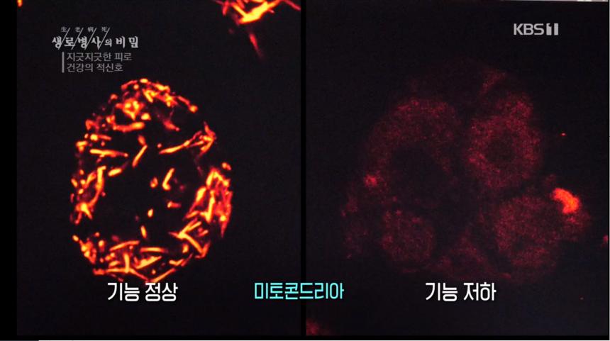 KBS1 ‘생로병사의 비밀’ 방송 캡처