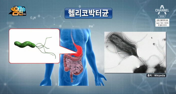 채널A ‘나는 몸신이다’ 방송 캡처