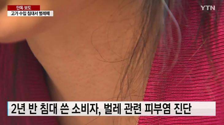 낙타털 침대 벌레 소비자 피부병 고통 / YTN 방송캡처