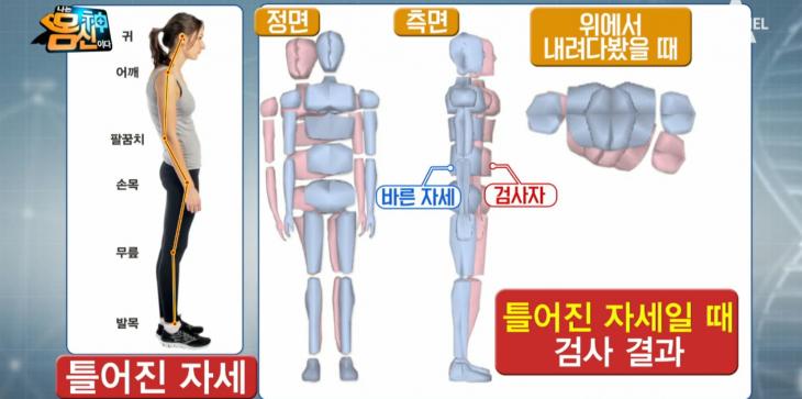 채널A ‘나는 몸신이다’ 방송캡쳐