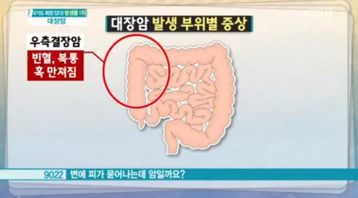 ​'무엇이든 물어보세요' 캡쳐​