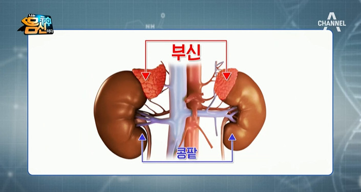 채널A ‘나는 몸신이다’ 방송 캡처