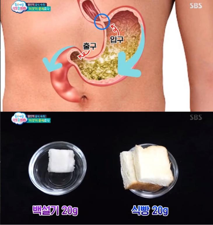 SBS '좋은 아침' 캡처