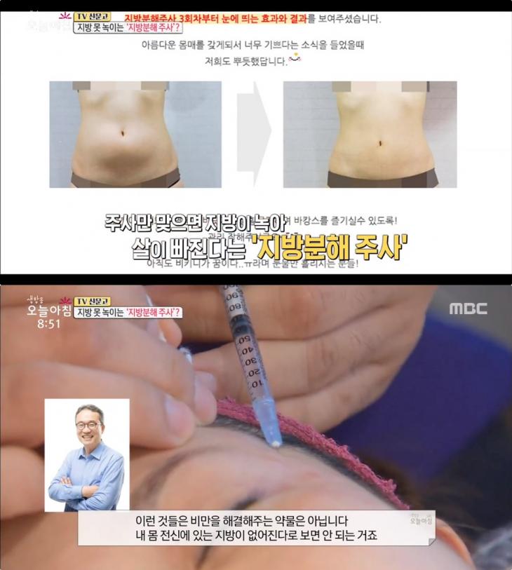 MBC ‘생방송 오늘아침’ 방송 캡처