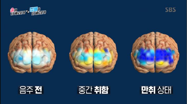 SBS ‘신동엽VS김상중, 술이 더 해로운가 담배가 더 해로운가’ 방송 캡처