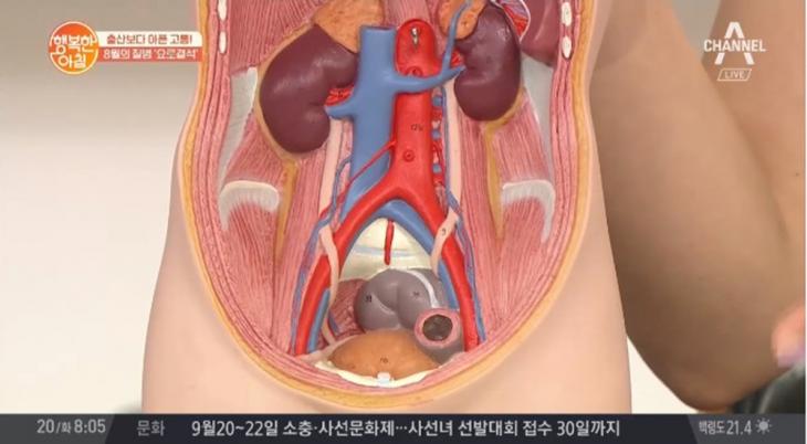 채널A ’행복한 아침' 방송 캡처