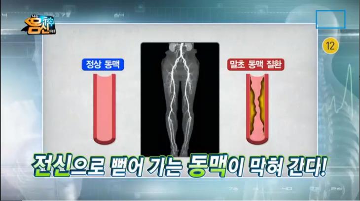 채널A ‘나는 몸신이다’ 방송 캡처