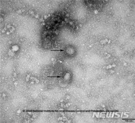 현미경으로 확대한 코로나바이러스 모습. 표면에 돌기가 형성돼있어 왕관 모양을 하고 있다.(사진=질병관리본부 제공) 2020.01.22. / 뉴시스