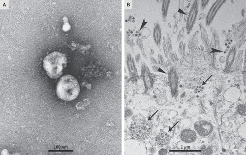 배양된 신종 코로나바이러스를 광학현미경으로 관찰한 모습 [NEJM 논문 발췌]