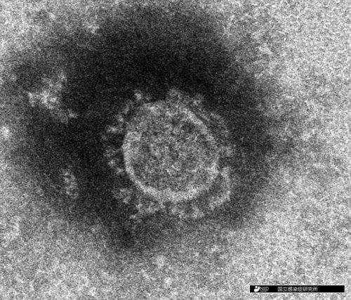 일본 국립감염증연구소가 분리해 낸 신종 코로나바이러스 전자현미경 사진. [연합뉴스 자료사진]