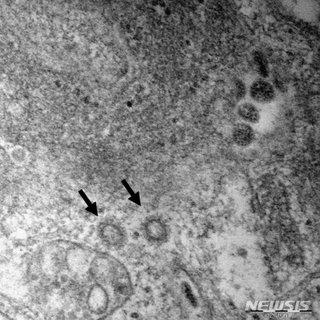 질병관리본부는 6명의 신종 코로나바이러스 감염증(코로나19) 환자로부터 얻은 코로나19 바이러스(SARS-CoV-2)의 고해상 전자현미경 사진을 공개했다. (사진=질병관리본부 제공) 2020.02.27. / 뉴시스