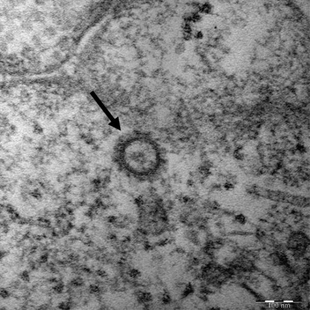 코로나바이러스 감염증(코로나19) 유전자의 고해상 전자현미경 사진. 2020.2.27 [질병관리본부 제공] 