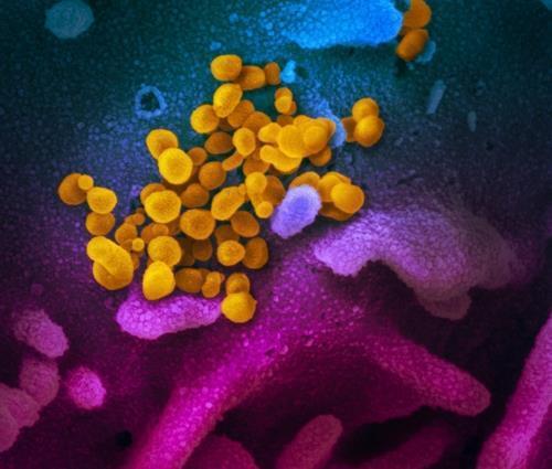 신종 코로나바이러스(노란색)가 세포 표면(청색·분홍색)에 몰려 있다. 미국 확진자의 검체를 배양해 전자현미경으로 관찰한 것이다. [미 NIH 국립 알레르기 감염병 연구소 제공]