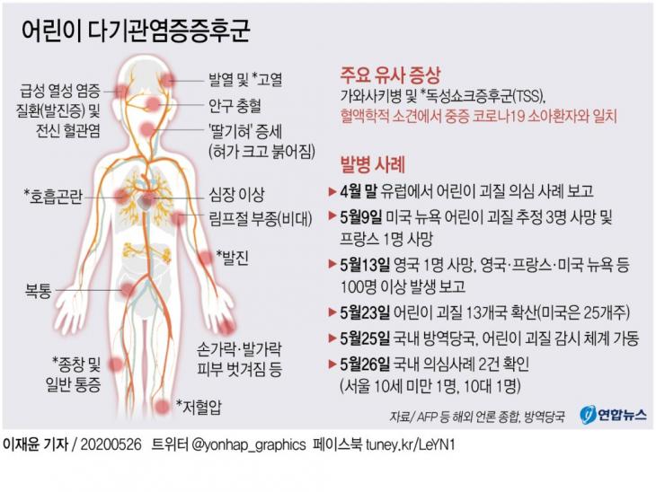 어린이 다기관염증증후군 / 연합뉴스