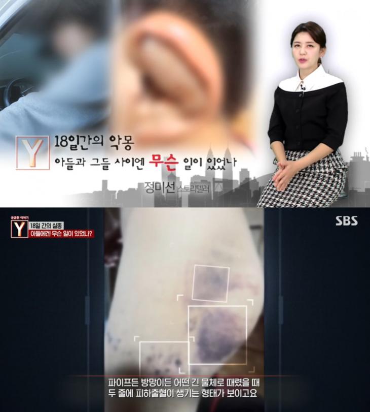 ‘궁금한이야기y 18일간 실종된 지적장애 아들 고등학교 동창 4인조에 쇠파이프로 맞고 물고문 당하고 귀가 ‘경악 2 배수정 기자 톱스타뉴스 