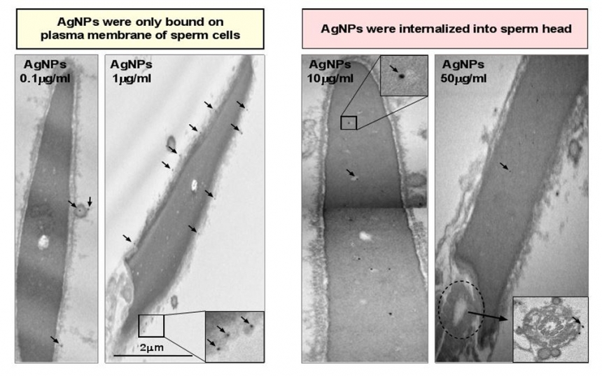 건국대 연구팀 “은나노, 생식세포· 임신중 태아에 치명적 결함 유발”