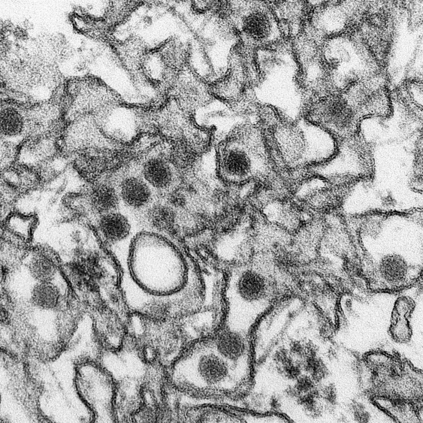 Zika 바이러스의 전자 현미경 사진 / wikipedia