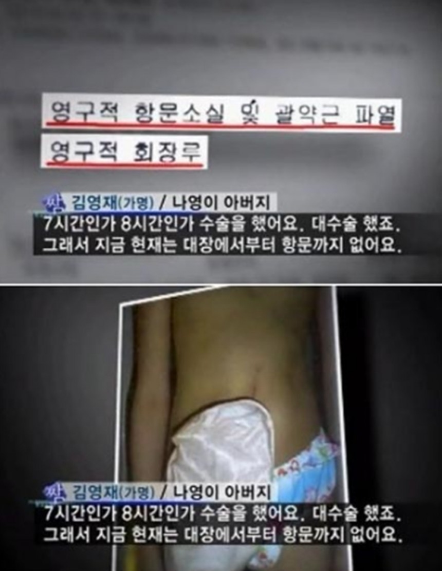 조두순 사건/ KBS 방송 캡처