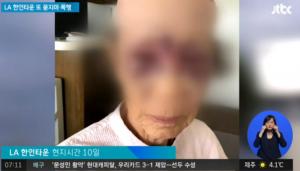 LA 한인타운, ‘묻지마 폭행’ 또 발생…증오·인종 범죄 가능성 높아