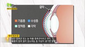 ‘2TV 생생정보’ 눈물이 주룩주룩…환절기 눈 건강 적신호, 안구건조증