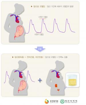 임신중독증, 방치하면 사망까지 이를수 있어…작년 한해 1만 명 진단