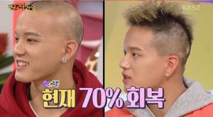 ‘대국민 토크쇼 안녕하세요’ 비투비(BTOB) 프니엘, 탈모 고백한 뒤 현재 70% 호전