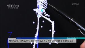 ‘생로병사의 비밀’ 엄홍길과 함께하는 올바른 등산 방법, 복근과 대퇴 주변 ‘파워존’을 키워라!