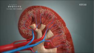 ‘생로병사의 비밀’ ‘만성 콩팥병’을 부르는 고혈압과 당뇨, 개념-원인과 증상은?
