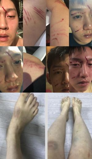 구하라-전 남자친구 최종범, 상처 다시보니…‘리벤지 포르노’로 번진 치정 싸움 