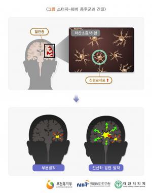 스터지베버증후군, 희귀적으로 발생하는 혈관종 피부 증후군…발생 빈도 증가하는 추세