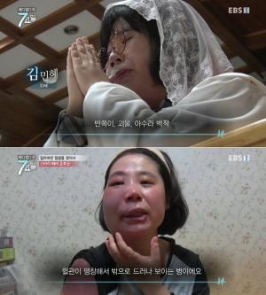 스터지 베버 증후군, 혈관이 팽창해서 밖으로 드러나는 희귀 질환…증상은?