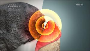 ‘생로병사의 비밀’ 잇몸병 치주질환 예방은 양치질, 식후에 바로 해야 하는 이유