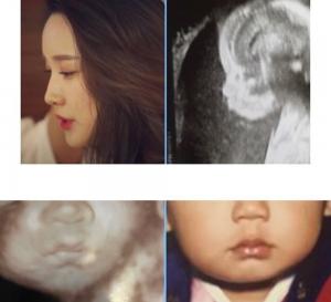 최현상 아내 이현승 기상캐스터, 임신 중 초음파 사진 공개 “유전자의 신비”