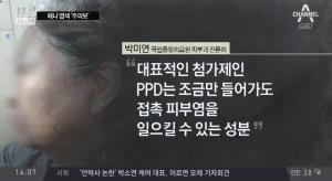 헤나염색 부작용, 첨가제 PDD에 의해 유발돼…‘PDD란?’