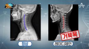 ‘나는 몸신이다’ 레이디제인, 거북목 판정받고 ‘망연자실’…오한진 “커브가 엉망”