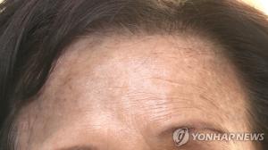 ‘헤나염색 부작용’ 잇따라 얼굴 검게 착색… ‘염색 전 패치테스트 꼭 먼저 하세요’