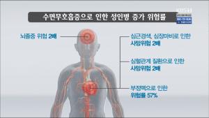 [종합] ‘생로병사의 비밀’ 성인병 동반하는 코골이와 수면무호흡증, 양압기와 수술 중 무엇을 선택할 것인가